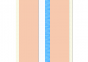 Insulated closure (1986-1991-Zone C-D) [350.0]