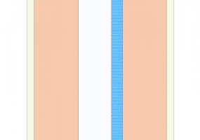 Fermeture isolée (1976-1985-Zone E-F) [400.0]