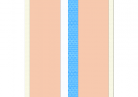 Insulated closure (1986-1991-Zone C-D) [350.0]