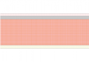 Slab steel profiles and infill blocks [215.0]